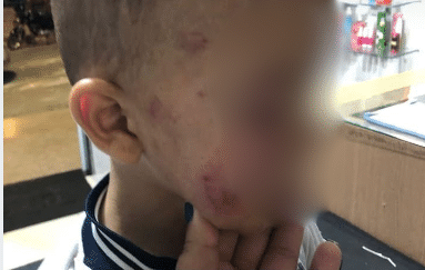 Mãe encontra bebê ferido na escola